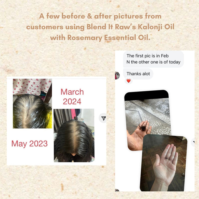Kalonji and Rosemary Essential Oil for Hair Growth